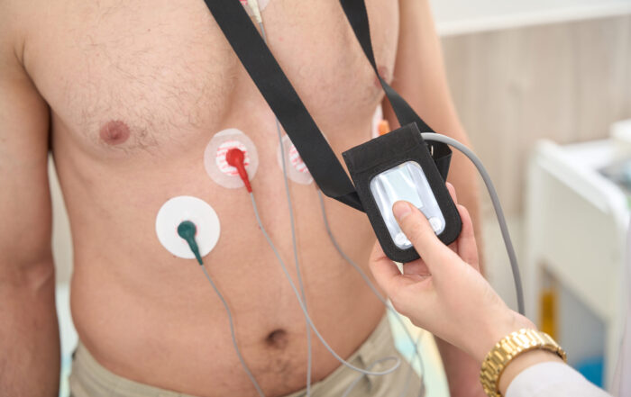 ECG Analysis for Beginners - Treatment