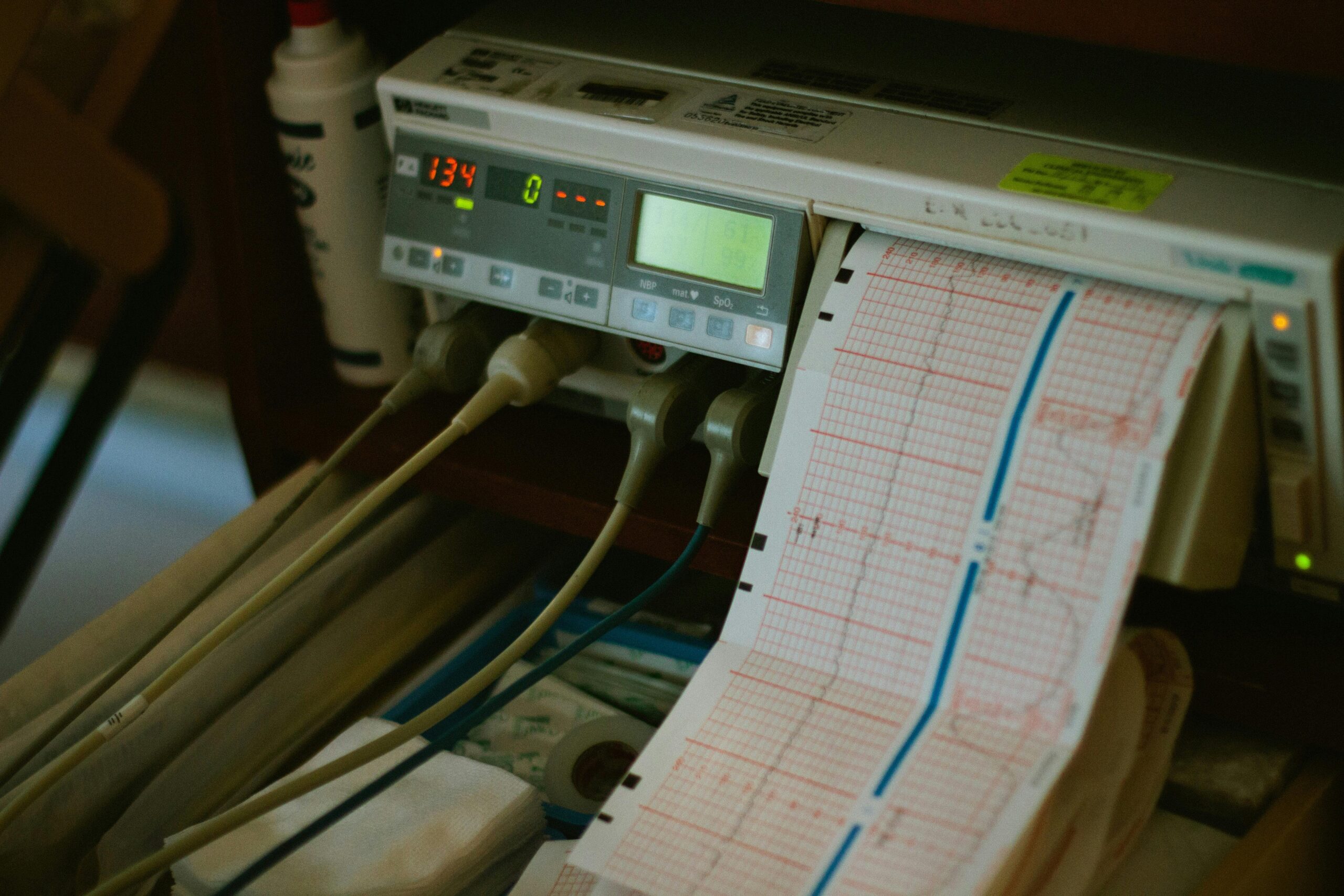 Normal ECG Reading Explained Essential Insights Everyone Needs to Know ECG