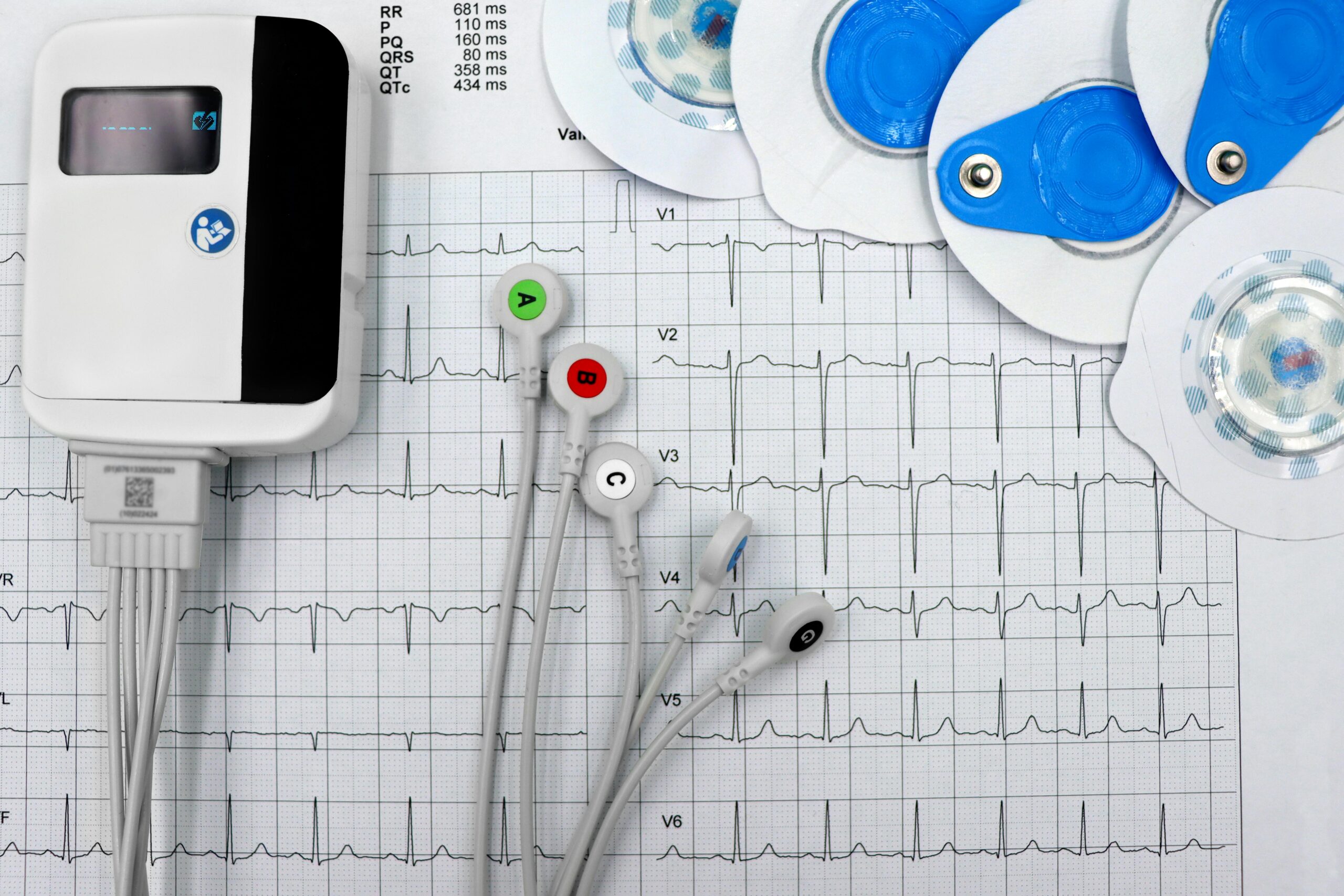 Normal ECG Reading Explained Essential Insights Everyone Needs to Know ECG